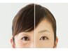 目元のたるみ・血行・くま改善／【眼鍼】目元に特化　　¥18980→初回¥8980