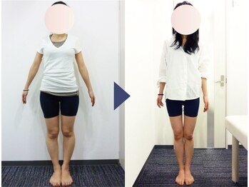 美デザイン 表参道店(美.design)/☆美脚Ｏ脚+美尻骨盤+お腹くびれ