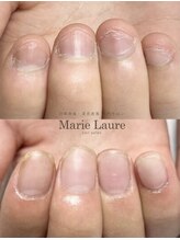 マリーロール 天王寺店(Marie Laure)/自爪育成/深爪矯正/ネイルケア