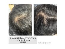 ミリュー(Milieu.)/Milieu.のスカルプケア