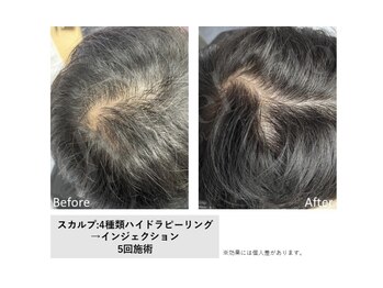 ミリュー(Milieu.)/Milieu.のスカルプケア