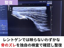 高津接骨院/骨を元の位置に戻す「整復」