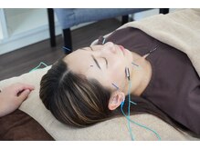 ゆしんアネックス/美容鍼