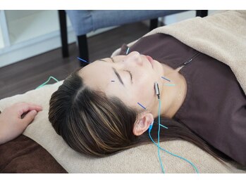 ゆしんアネックス/美容鍼