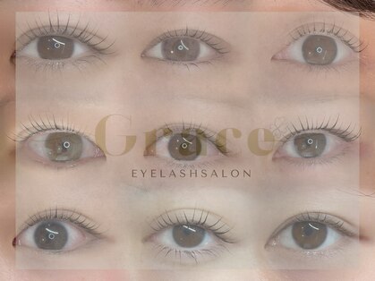 グレース(Grace)の写真