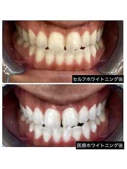 エピジュ(Epijyu)の写真/【GW限定！ 5/3.4.5.6】脱毛サロンがホワイトニング専門店に！歯科提携メニューも初回特別価格1,800円！！