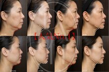 多穏スキンケア(skin care)