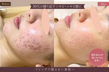 アロマ(AROMA)