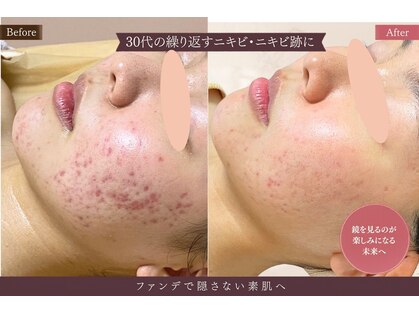 アロマ(AROMA)の写真