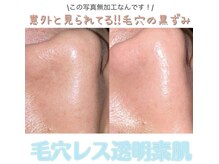 毛穴ケアBefore&After