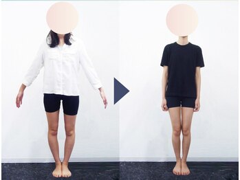 美デザイン 表参道店(美.design)/☆美脚Ｏ脚矯正+美尻骨盤矯正