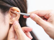 ピュアドール(PureDoll)/耳つぼは目立ちにくいです