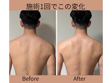 アイセ(AISE)の雰囲気（男性のお客様にも人気！強もみマッサージでしっかりリセット）