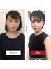 【人気No.1小顔矯正】たるみ改善×顔のゆがみ｜60分￥8,980