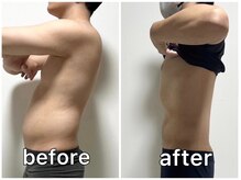 サンク(Cinq)/【整体＋骨盤矯正】反り腰改善