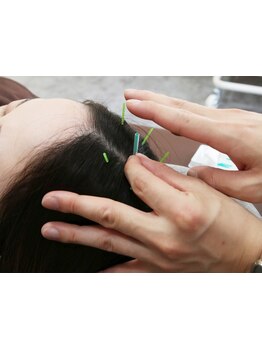 スゴ腕の施術者がいるサロン