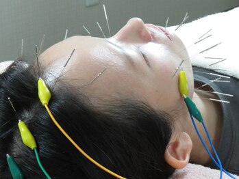 たかや鍼灸 整体院/美容鍼×筋肉を動かす電気