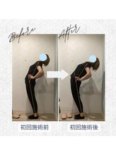 ラクリエ 東加古川院(La Creer)/お客様ビフォーアフター