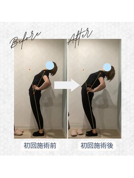 ラクリエ 東加古川院(La Creer)/お客様ビフォーアフター