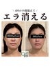 【エラ・むくみ改善】小顔矯正＋高濃度酸素オイルリンパケア￥9900→￥8400 
