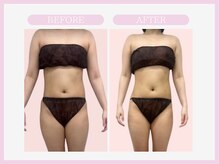 スリムライン 盛岡店(The Slim Line)/before→after