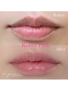 リラ(Lyra)/　RomaPink