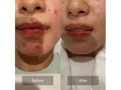 ラナン(ranan)の写真