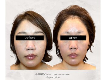 エスポワールカルド(Espoir caldo)/