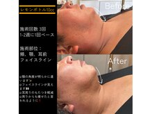 ベル(BELLE)の雰囲気（水光ピール毛穴エクストラクションPRO/ホワイトラボ/シミケア）