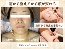 ミスティア(mistia)