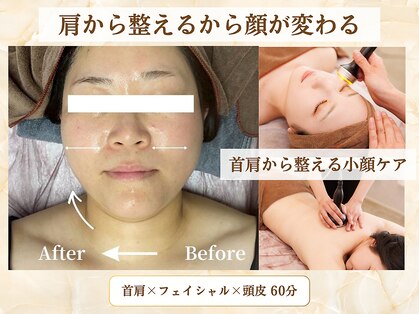 ミスティア(mistia)の写真