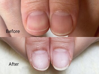 グラシナ なんば店/深爪/自爪育成/フィルイン