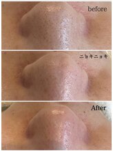 マヴィ くずは店(MavY.)/ニョキニョキパック