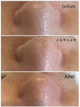 マヴィ くずは店(MavY.)/ニョキニョキパック