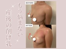 プレフィール(PLEAFEEL)の雰囲気（産後のしぼみ乳諦めないで！正しくケアすれば復活します☆）