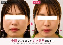 サロンドエステケイワイ(de KY)