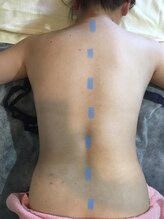 サブリエ(SABLIER)/痩身ジェル　右のみ塗布の効果