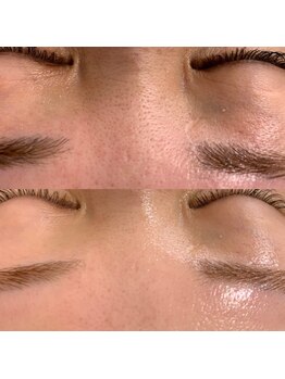 ナウ(now)/【陶肌トリートメント】