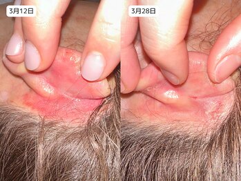 レイル(REIR)/ピュールボーテ/富士の不動水