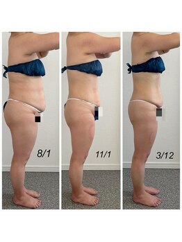 グレース(Grace luxe)/短期間３ヶ月で別人級痩せ続々☆