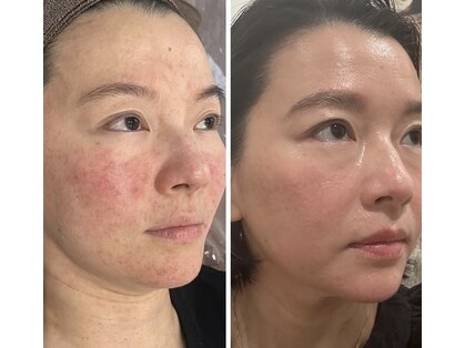 BBC 田園調布の写真