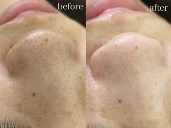 テオリア(TEORIA)/