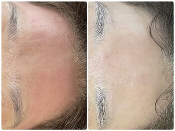 ラヴィ(Ravi)/乾燥肌、シワ改善