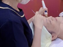 アン(AN)/アイケアホワイトニングの施術