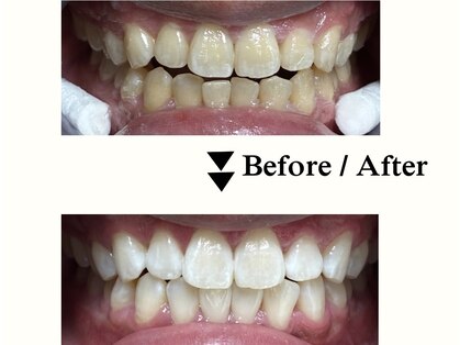 ラポ(Lapo)の写真