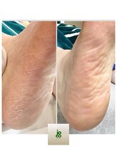 ジョーコーネイル(joco nail)/