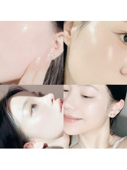 ノノサロン(nono salon)の写真/顔の毛穴は20万個！毛穴開き/たるみ/角栓詰まりには毛穴改善プログラムが◎