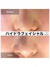 【8月限定】韓国肌管理♪毛穴徹底洗浄×ビタミンC導入で毛穴レス肌へ90分