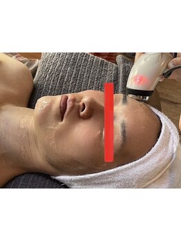 ホウレイ線・たるみ改善！予防ケア