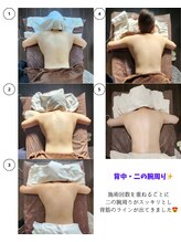 サンシャイン(Sunshine)/20代女性ビフォーアフター